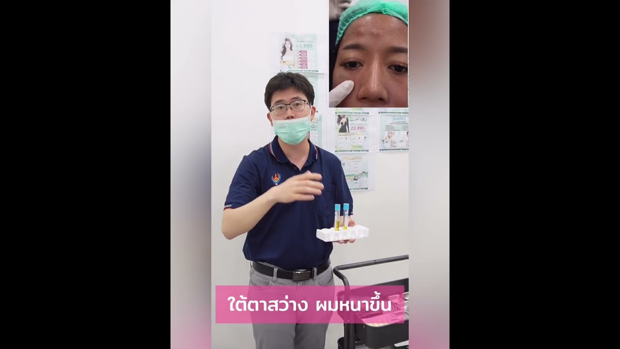 หมอต่อมาบอกวิธีแก้ปัญหาผมร่วง ผมบาง ใต้ตาคล้ำ หน้าหมอง แก้ได้ด้วยPRP